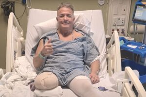 Analysis: Ex-WWE Superstar Has Right Leg Amputated After 2020 Car Accident