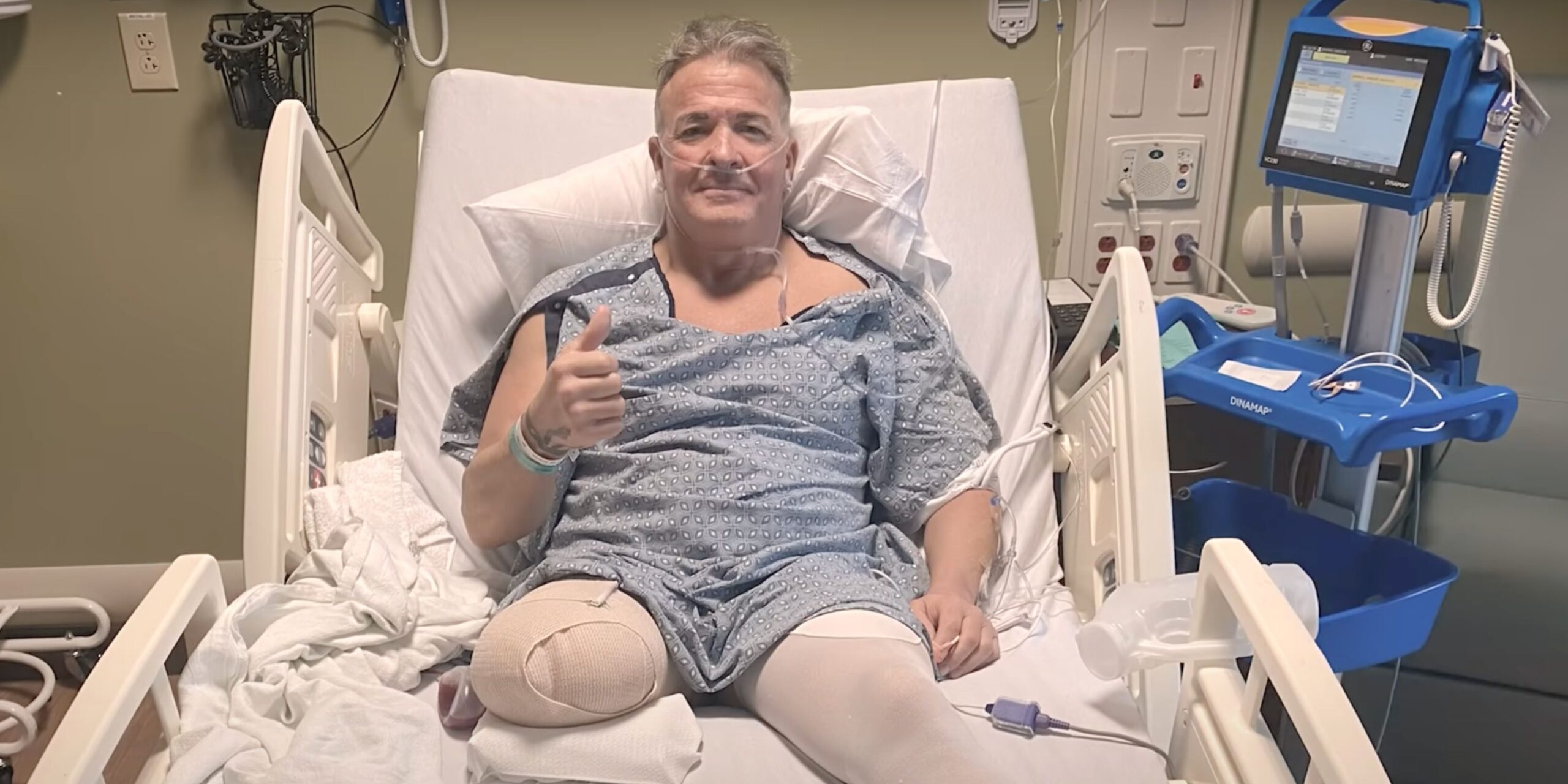 Ex WWE Superstar Has Right Leg Amputated After 2020 Car Accident