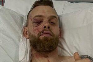 Speedway: Tobias Thomsen Left With Horror Injuries After Sickening Crash — Key Details