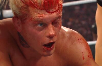 WWE WrestleMania 42: Photo of Cody Rhodes' Eye That Will Keep Him Out 'Indefinitely'